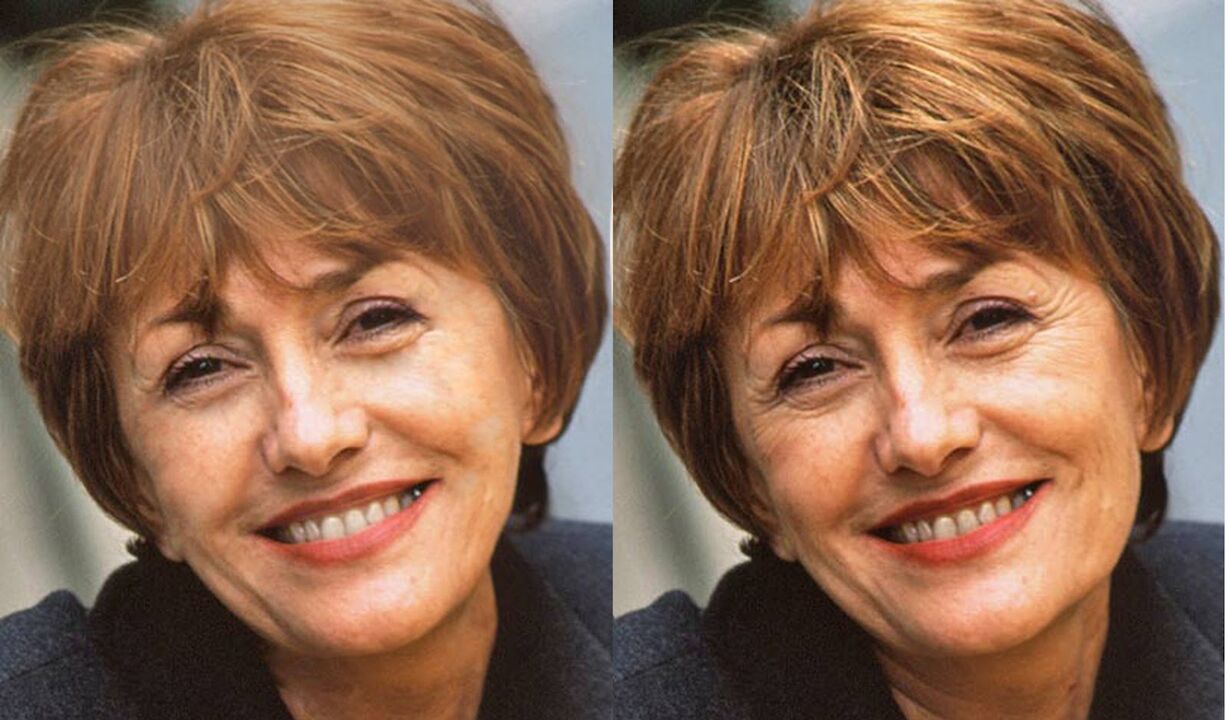 fotografie obličeje před a po konturování